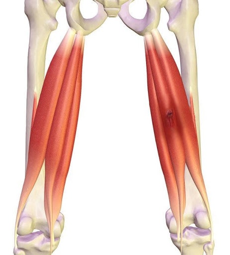 Hamstring strain