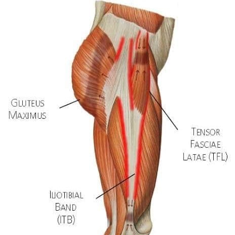 Treating the Iliotibial Band (ITB), Tensor Fasciae Latae (TFL), Hip  Restrictions, Hip, ITB, ITBS and more