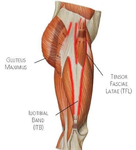 What is iliotibial band friction syndrome and what are its causes?