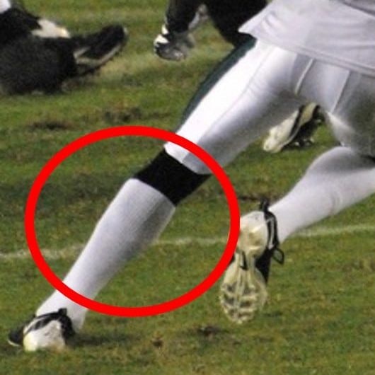 football blog week 2 calf injury photo cropped