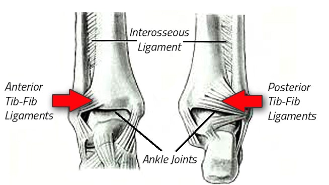 high ankle bone & ligament photo
