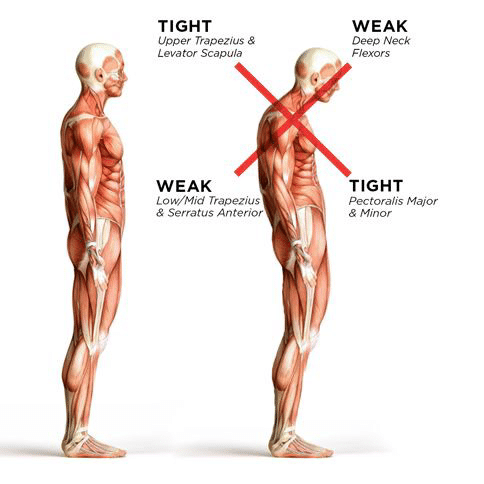 What's Causing Your Tense Shoulders & How to Ease the Tension