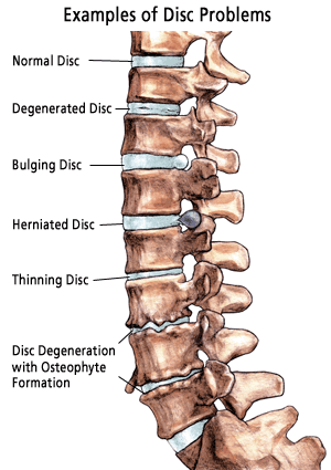 Examples of disc problems