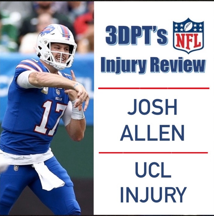 Josh Allen